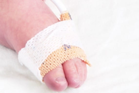 NONIN 6000C-Sensor do pulsoksymetru neonatologiczny jednorazowe tkaniny pulsoksymetryczne